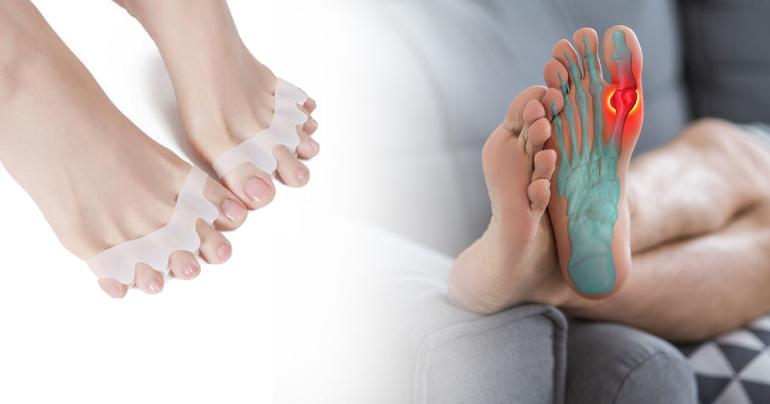 Hallux valgus korrigerande tåseparerare på Digdeal.se