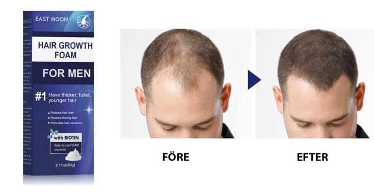 Extra Strength Hair Growth Scalp Foam för män på Digdeal.se