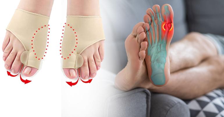 Hallux valgus korrigerande stöd på Digdeal.se